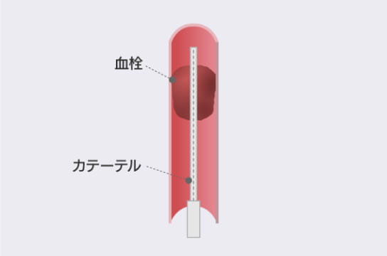 STEP3 イメージ