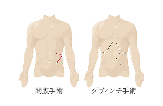 患者さんへの負担が軽減