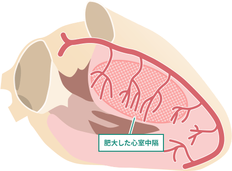 心臓図